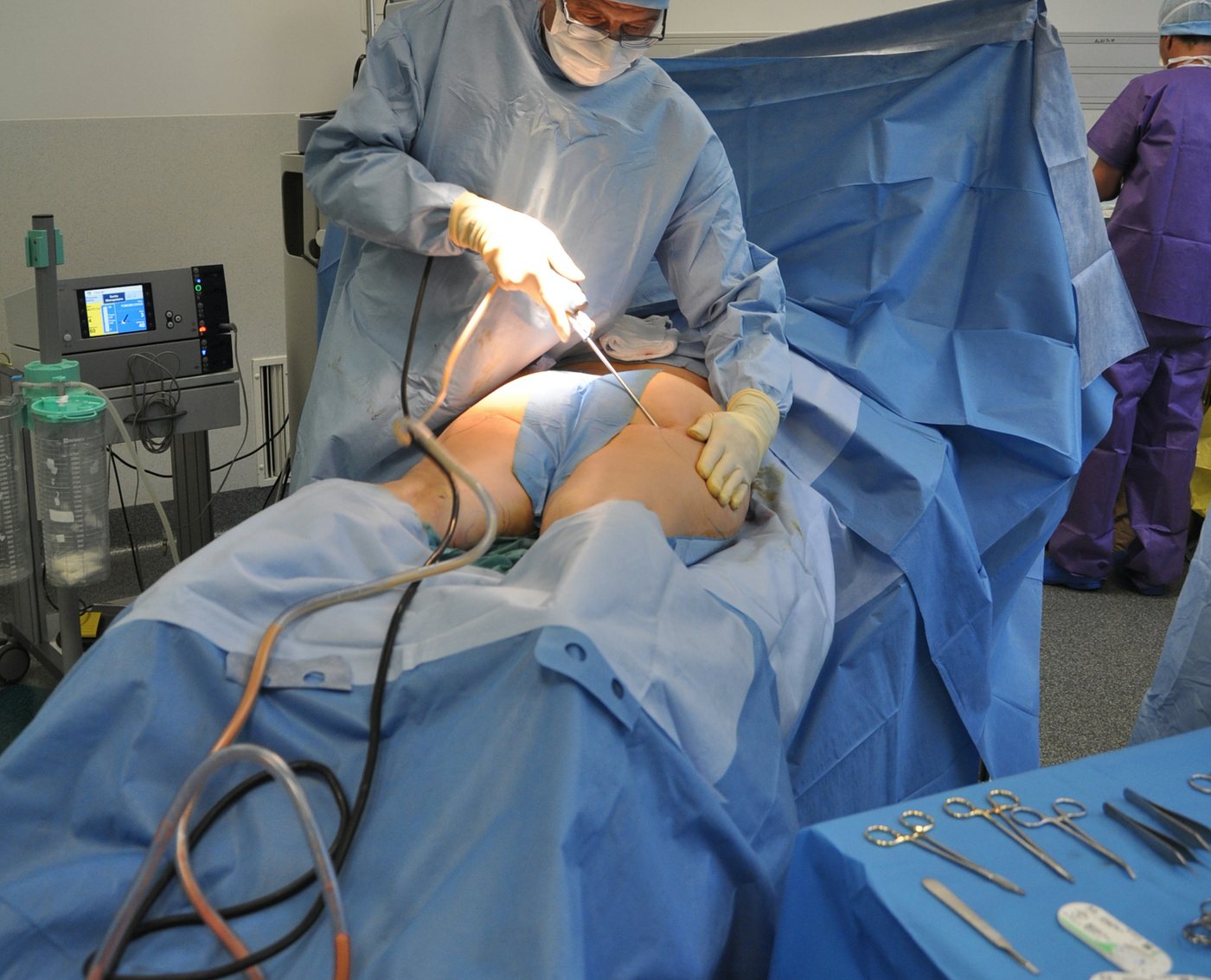 Operating on a foot and ankle case
